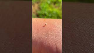 Bee stings then poops on my hand. #calm #beekeeping #bees #youtubeshorts #beekeeper #gross