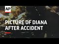 France Picture Of Diana After Accident