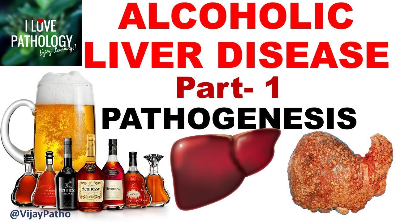 ALCOHOLIC LIVER DISEASE: Part 1. Pathogenesis