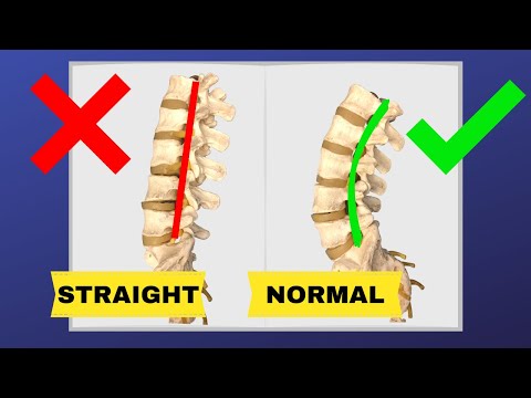How To Correct Straightening Of Lumbar  Spine (FIX LOSS OF LUMBAR LORDOSIS) | Dr. Walter Salubro