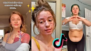 Embracing Body Insecurities (Body Positivity) | TikTok Compilation