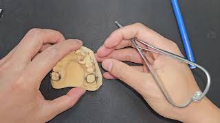 Lò xo Ballista trong kéo răng ngầm phía khẩu cái