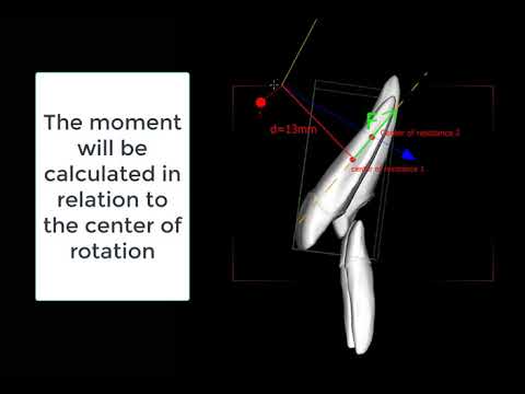 Center or Rotation Mechanics in Orthodontic Tooth movement as Applied to Aligners.
