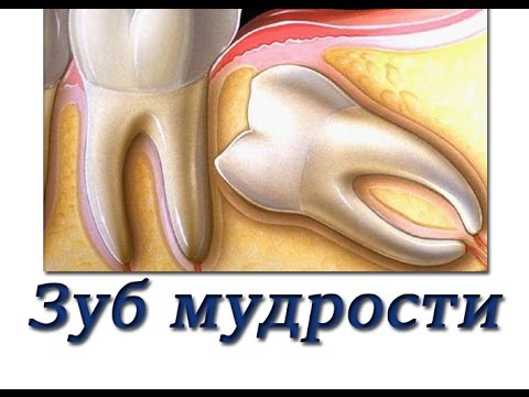 Смешанные контрактуры коленного сустава При остеохондрозе поднимается температура тела