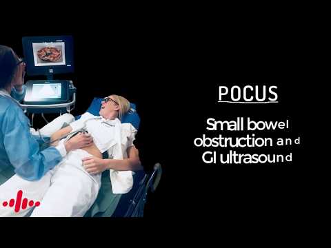 Point of care ultrasound in small bowel obstruction