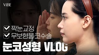 [성형 Vlog] 눈코성형을 위해 중국에서 왔습니다✈️｜눈매교정, 무보형물 코수술