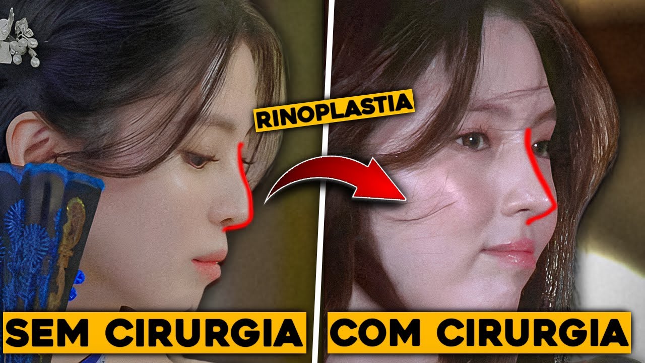 10 Atores Coreanos e suas Cirurgias Plásticas | (DESNECESSÁRIO)