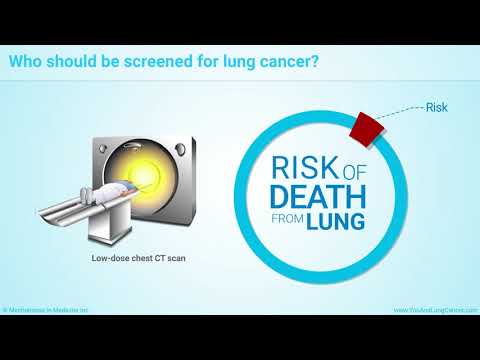 Diagnosis and Screening of Lung Cancer