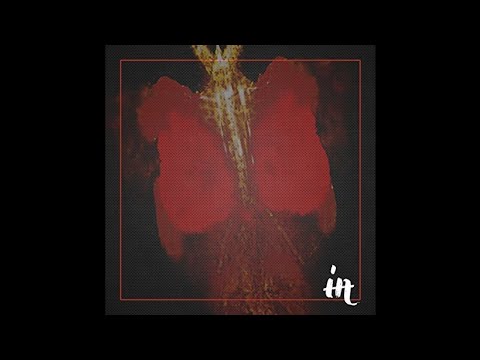 Evren Ulusoy & Mehmet Özbek - Fraternis  [Infamous Recordings]