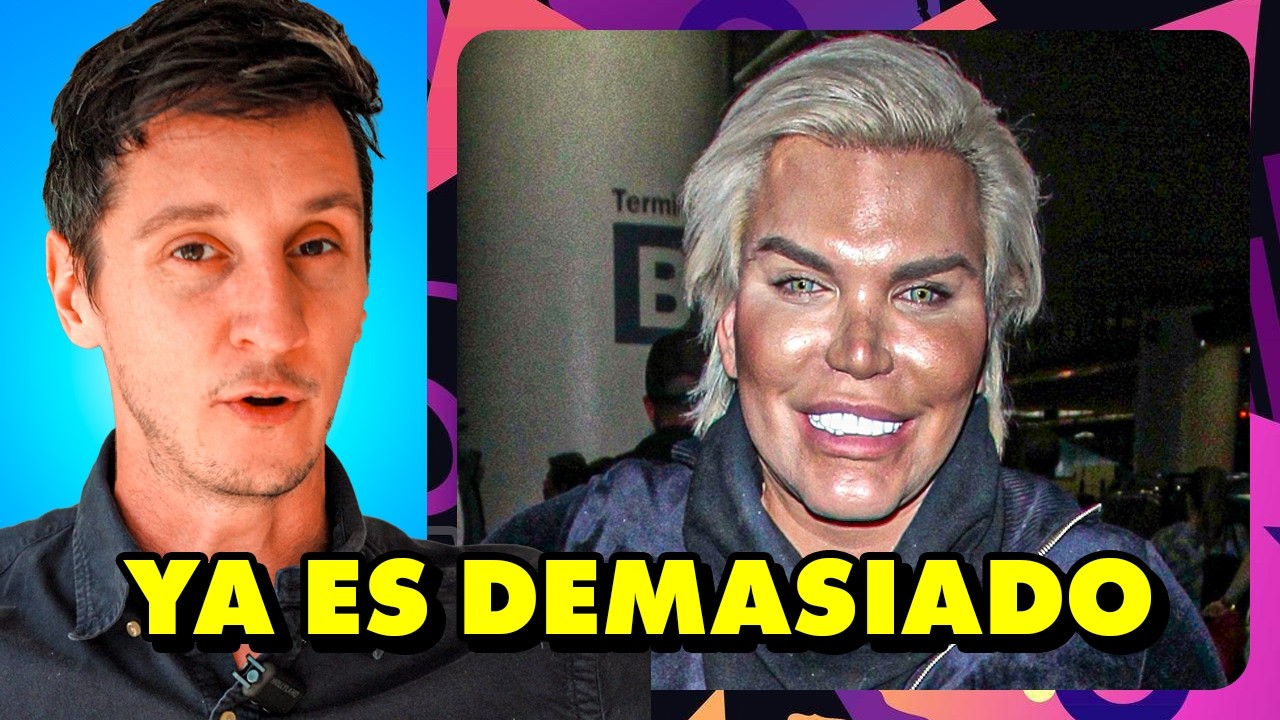 Cuando los actores se pasan de cirugías