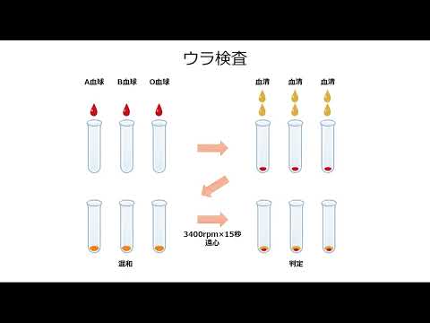 【山口大学OC2025／医学部／保健学科】Let's 血液型判定！