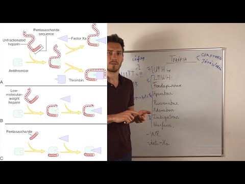 Epicondylitis condyle a könyökízület kezelése