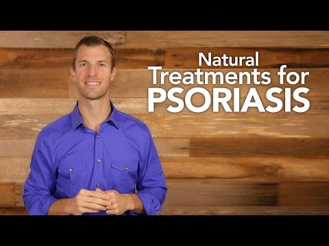 Psoriasis treatment in islamabad