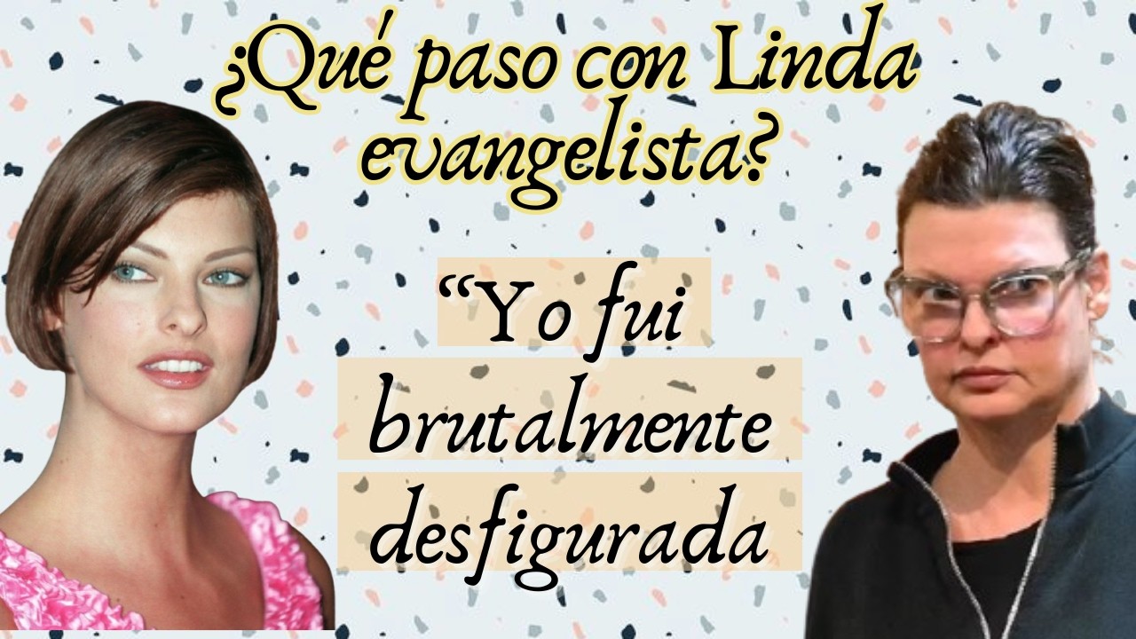 What happened to Linda Evangelista? Disfigured supermodel, cryolipolysis, cases and regret.