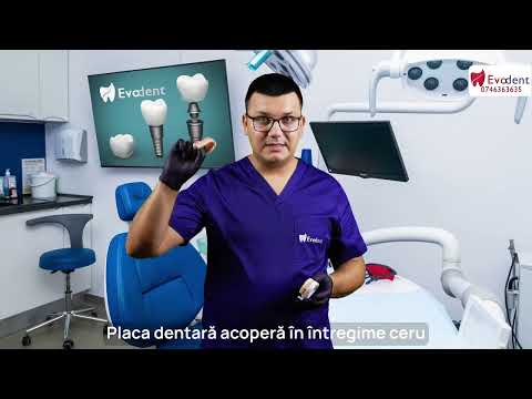 Vezi avantajele danturii fixe