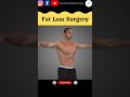 Weight Loss Fat Loss Surgery Viral