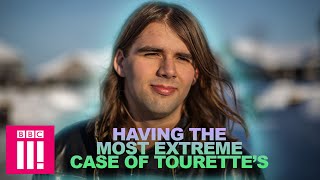 I Have the Most Extreme Case of Tourette&#39;s | Living Differently