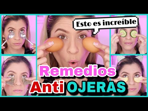 TRUCOS Y REMEDIOS CASEROS PARA ELIMINAR LAS OJERAS | ELIMINAR OJERAS EN CASA | NatyGloss