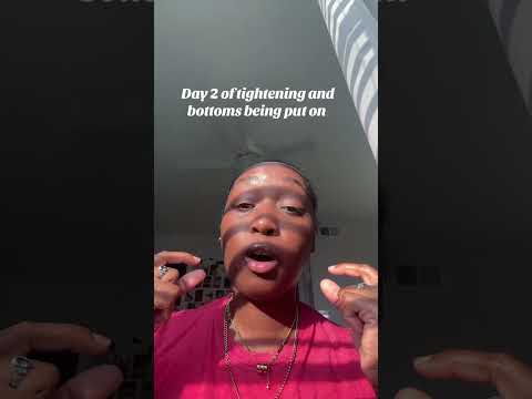 Braces update #braces #braceslife #bracestreatment