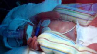 preview picture of video 'Rozthorne 2 pound Preemie Close up in the incubator'