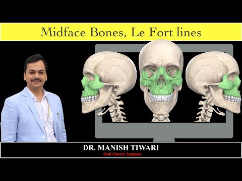 Le fort III fracture line | #StayHome and learn #WithMe