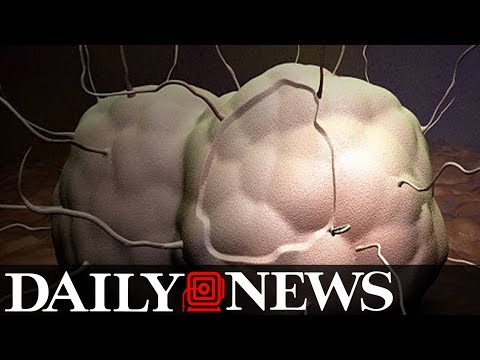 Untreatable ‘super gonorrhea’ on the rise and it's spread by oral sex