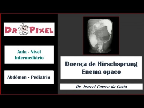 Doença de Hirschsprung