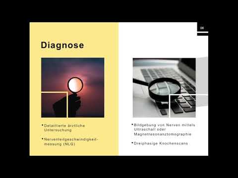 Dr. Georgios Matis - Neuromodulation - CRPS Überblick (🇩🇪)