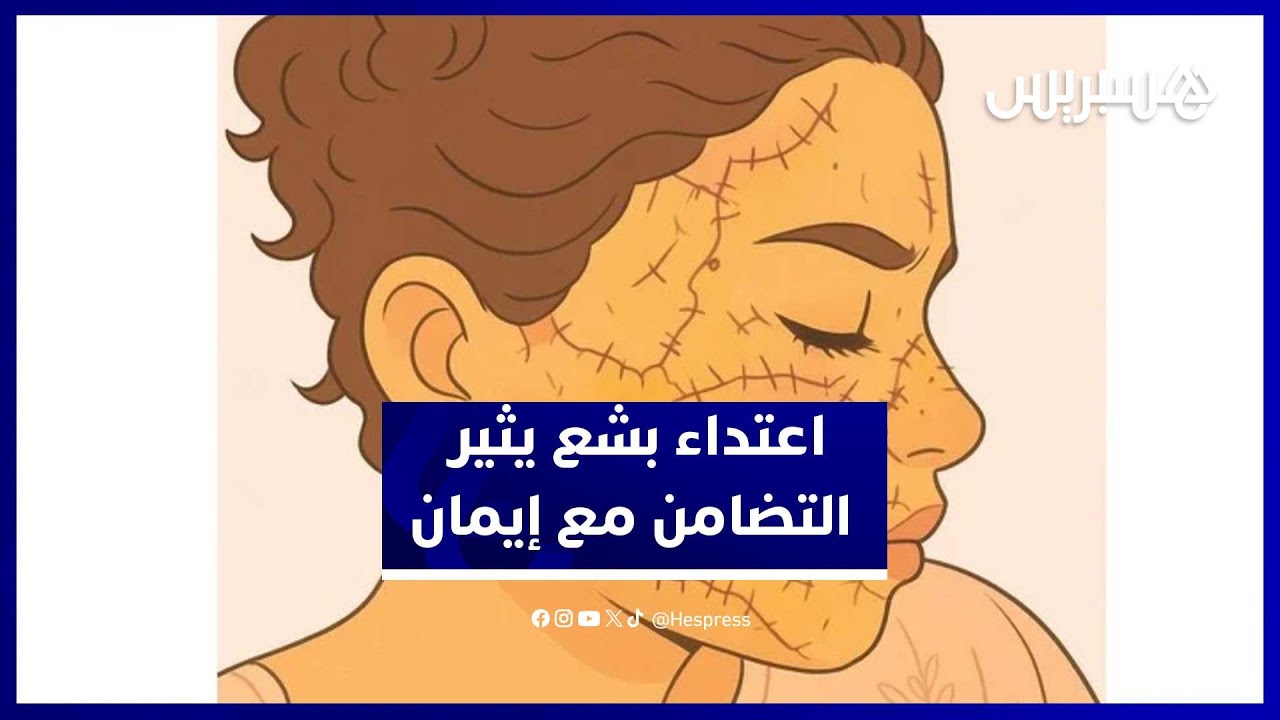 اعتداء صادم على إيمان يدفع حقوقيات للمطالبة بقوانين صارمة ضد العنف thumbnail