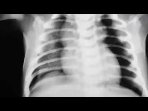 USMLE Practice Questions and Answers #44 | Anatomy