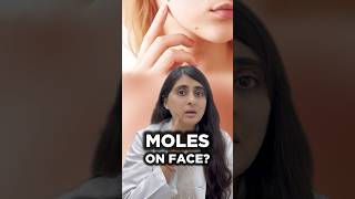 Download lagu How to get rid of moles on skin | How to remove moles on face | Moles treatment dermatologist mp3 Download lagu How to get rid of moles on skin | How to remove moles on face | Moles treatment dermatologist mp3