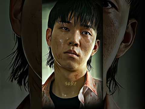 Sore Editz and Euri Editz