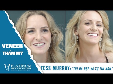 Review by Tess: "Tôi đã đẹp và tự tin hơn" | Smile Design | Platinum Dental Group
