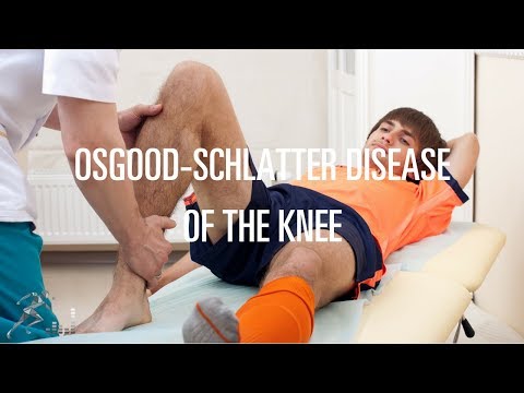 Osgood-Schlatter disease: Signs, symptoms and treatment options