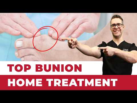 Heel Spurs Plantar Fasciitis BEST Home Treatment 2022