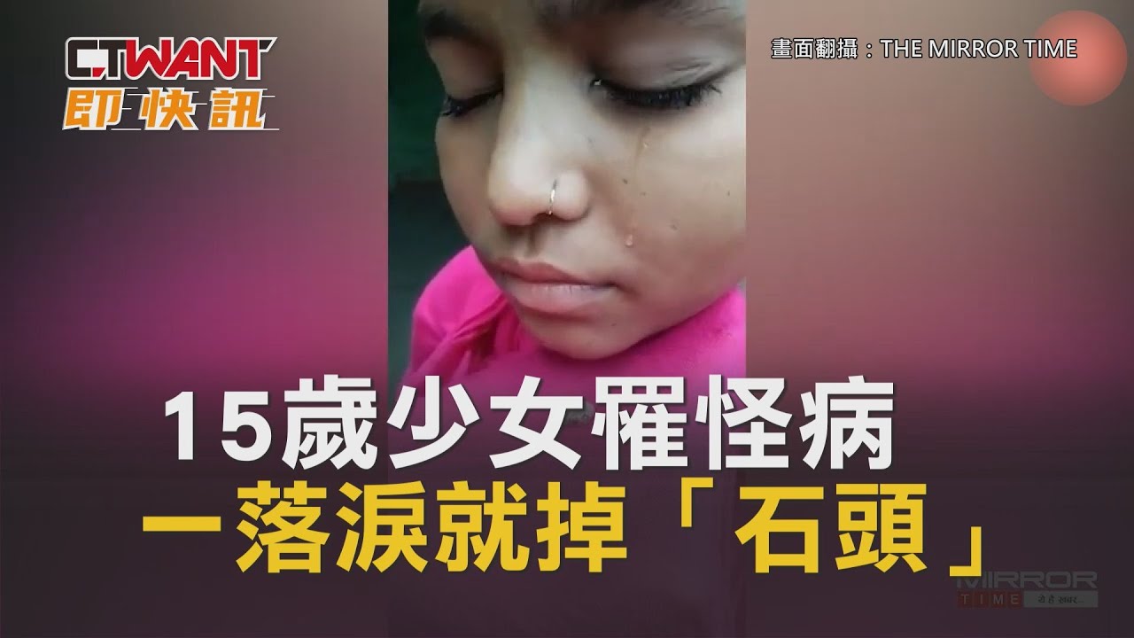圖說-15歲少女罹怪病　一落淚就掉「石頭」