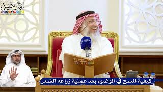 201- كيفية المسح في الوضوء بعد عملية زراعة الشعر - عثمان الخميس