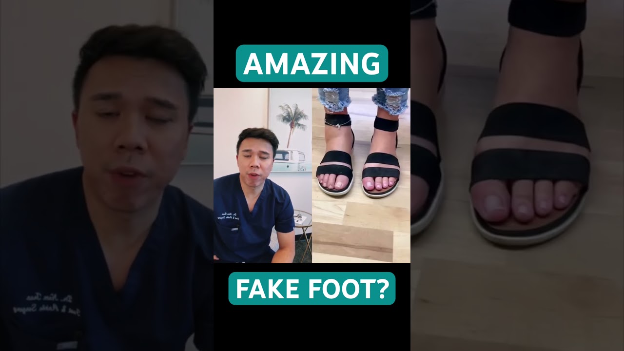 This prosthetic foot is absolutely AMAZING! #shorts #doctor #foot #prosthetics