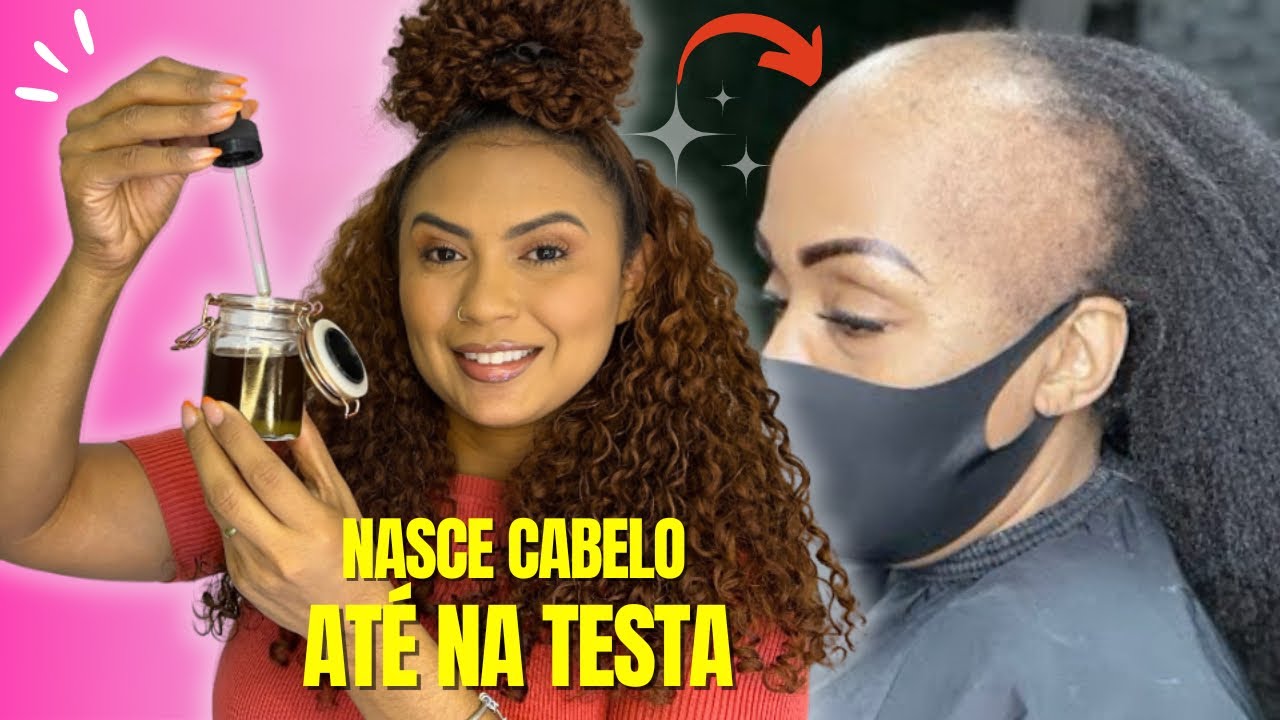 🆘 MEU CABELO CRESCEU EM 3 MESES USANDO ISSO ! AGORA SEU CABELO CRESPO VAI CRESCER MUITO RÁPIDO!!