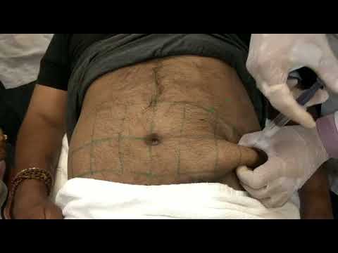 Lipo lab ppc solution weight loss injections to loose weight...