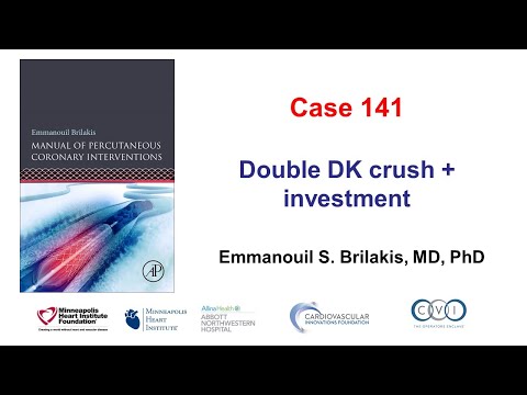 Case 141: PCI Manual - Double DK crush and investment