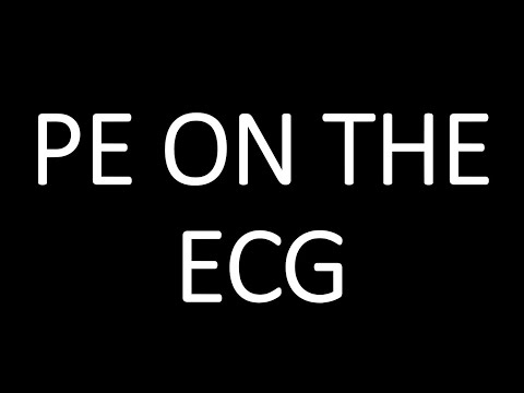 PE ECG
