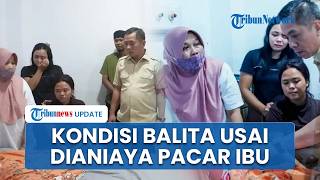 Kondisi Memprihatinkan Balita Korban Siksaan Tang oleh Pacar Ibunya di Karawang, Lidah Robek