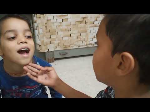 Ice cream ya teeth pain, Doctor garvit se chhotu ka appointment.