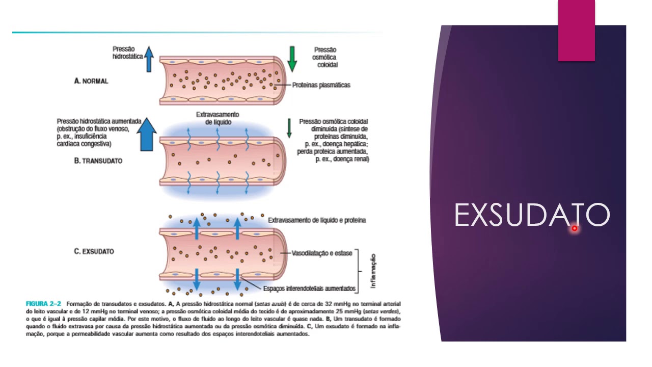 video aula INFLAMAÇÃO