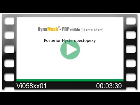 DynaMesh®-PRP visible 03 cm x 18 cm - OR-Video: Hysteropectopexy - Fixation Posterior