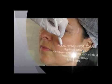 comment appliquer emla pour tatouage la r 233 ponse est sur comment appliquer emla pour tatouage la r 233 ponse est sur