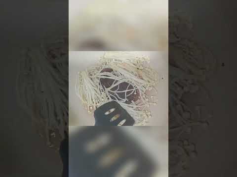 Delicious Enoki Mushroom Recipe for Ultimate Health #deliciouslyvegan #vegan #food