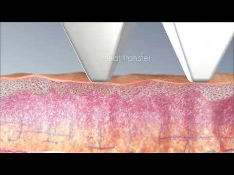 Mezotix  | ASTOMED klinikutrustning