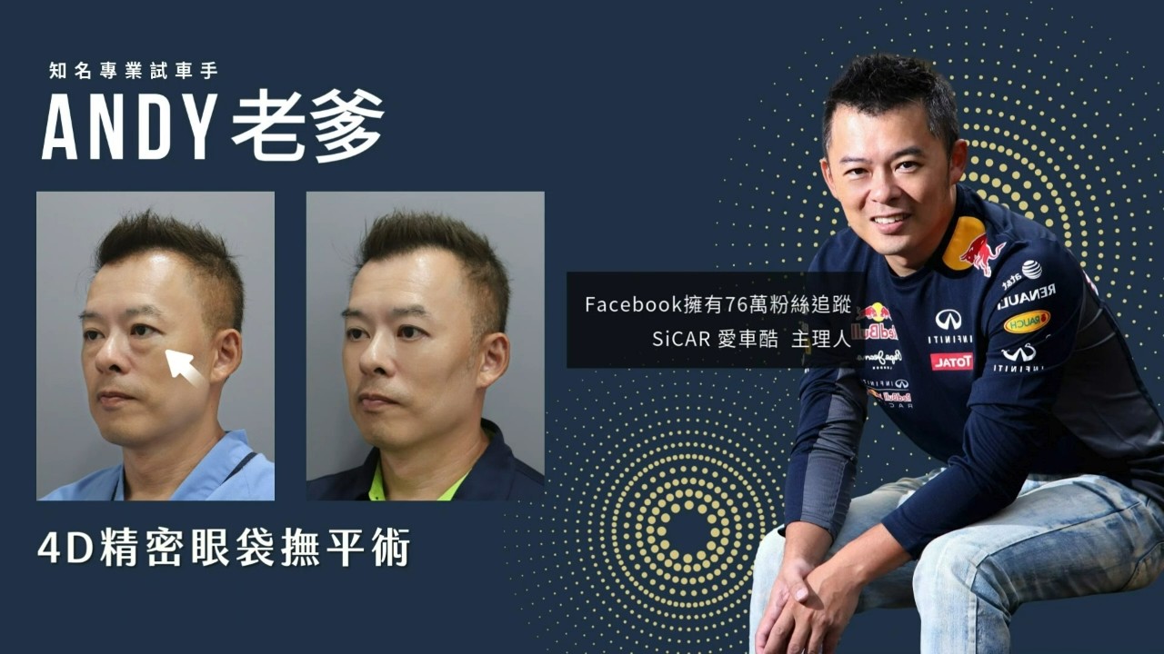 有精神才有氣場！Andy老爹的4D精密眼袋撫平術進化全紀錄 | 美加醫美